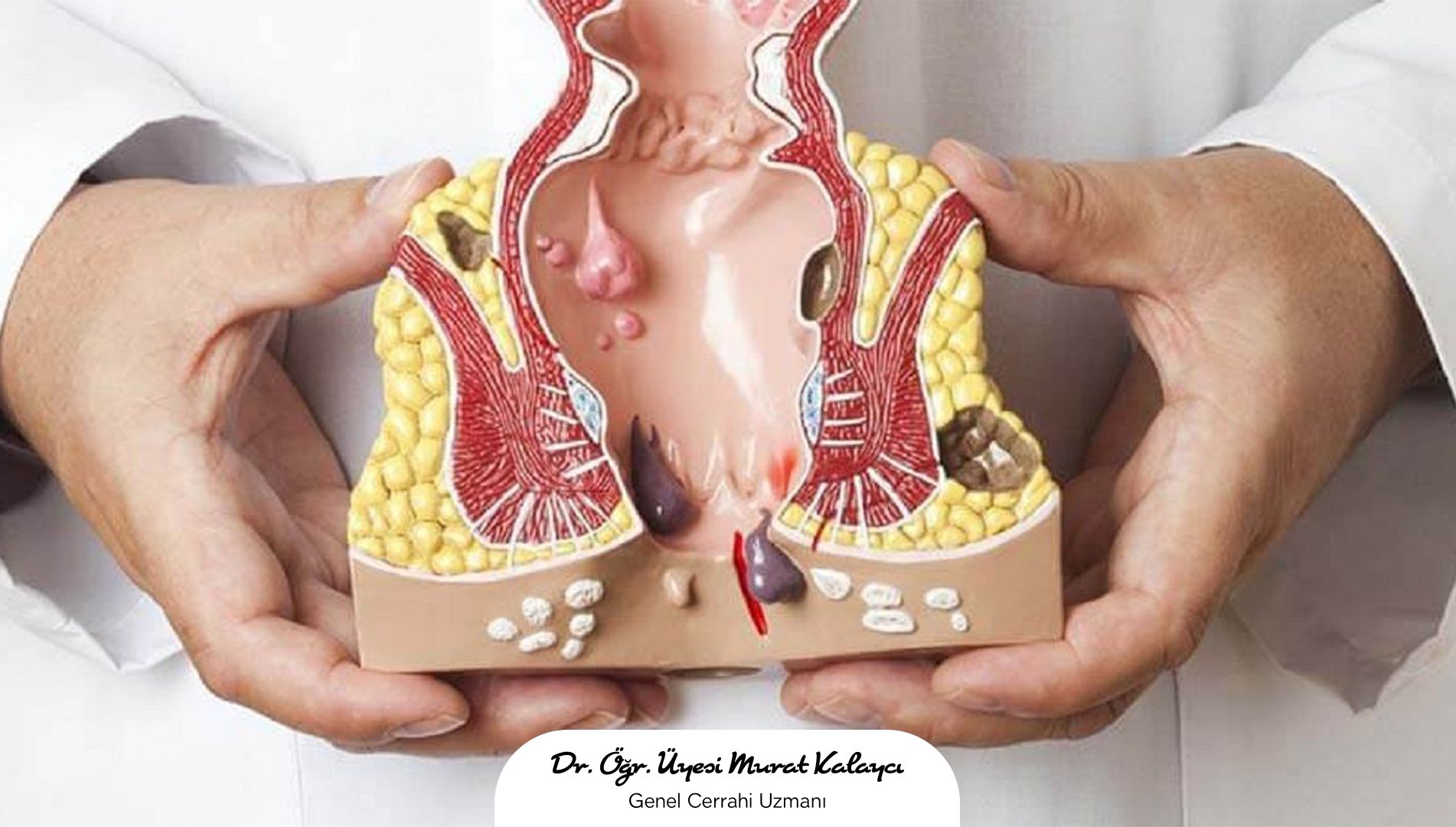 Makat çatlağı batma yapar mı? - Kapak Görseli